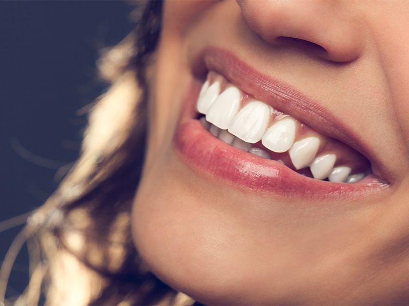 Are Whiter Teeth Really Healthier?