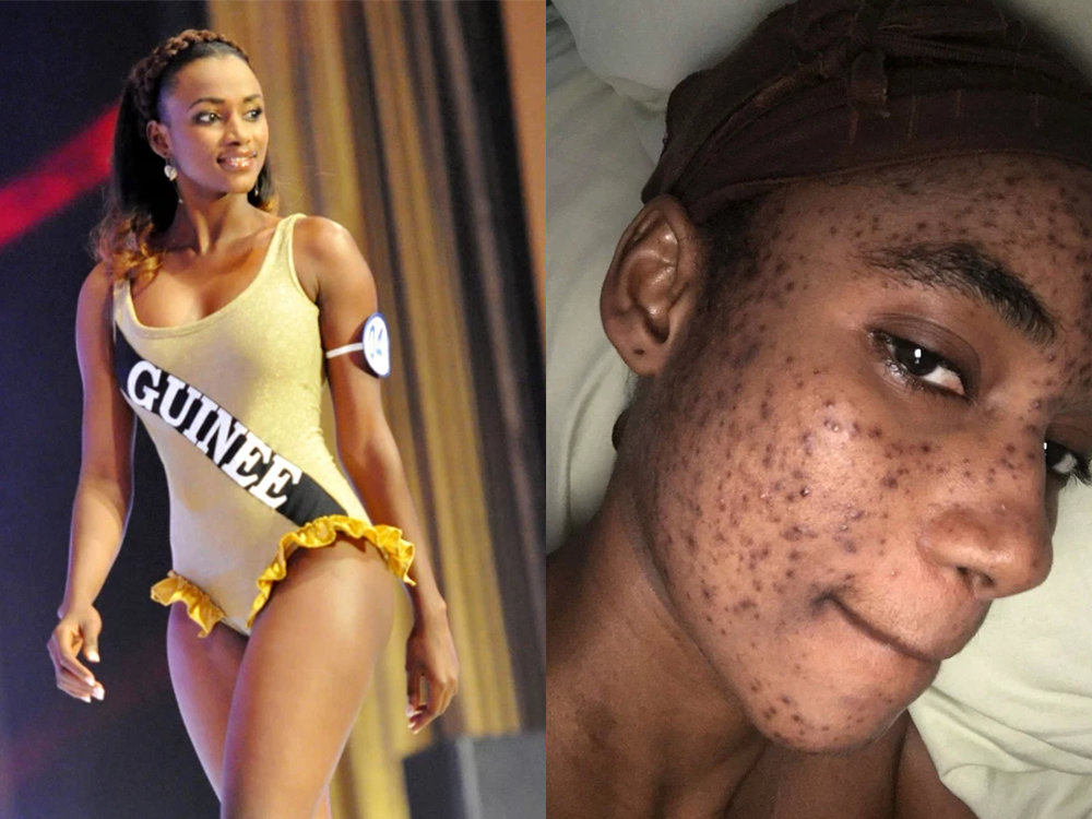 Model Claims This Skin-Care Line Caused Lifetime Worth of Damage on Her Once Flawless Complexion