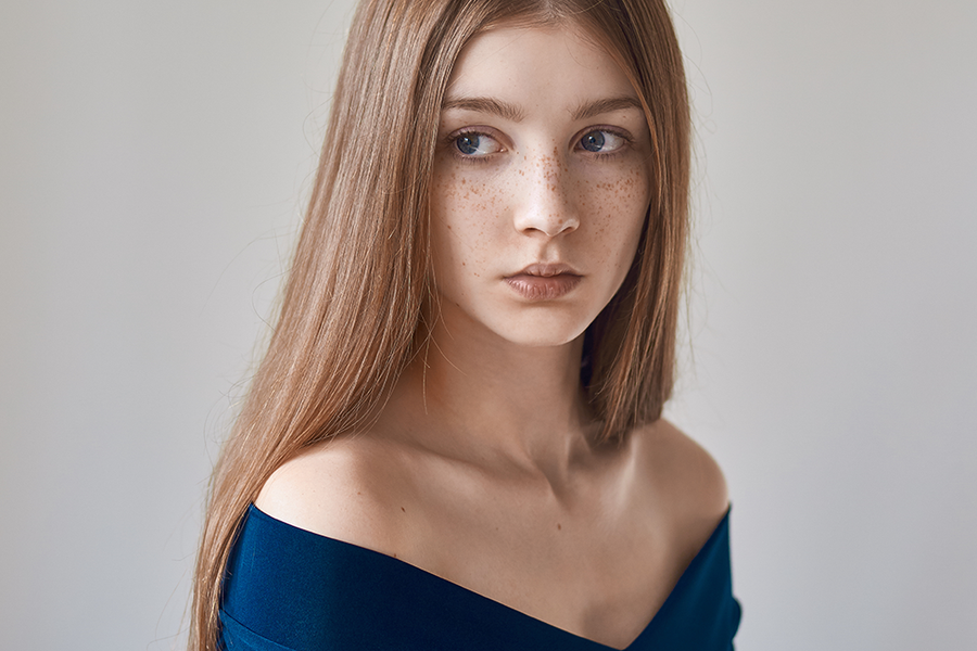freckles1