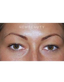 Dr. Roman Rayham - Youthful Outlook - Before