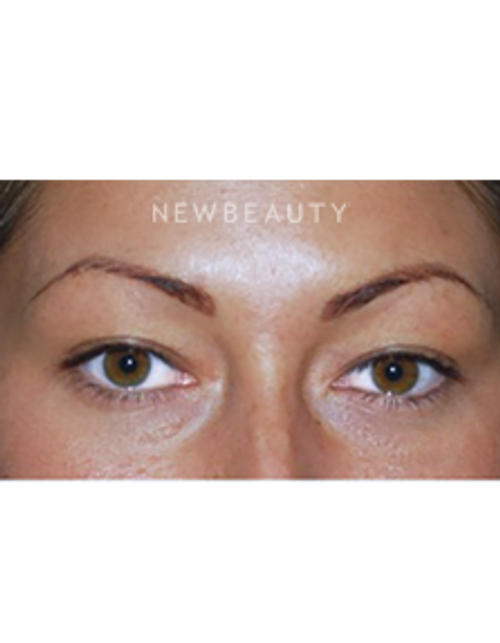 Dr. Roman Rayham - Youthful Outlook - Before