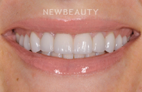 Dr. Salvator J. La Mastra - Transformative Upgrade - 44409698 - After