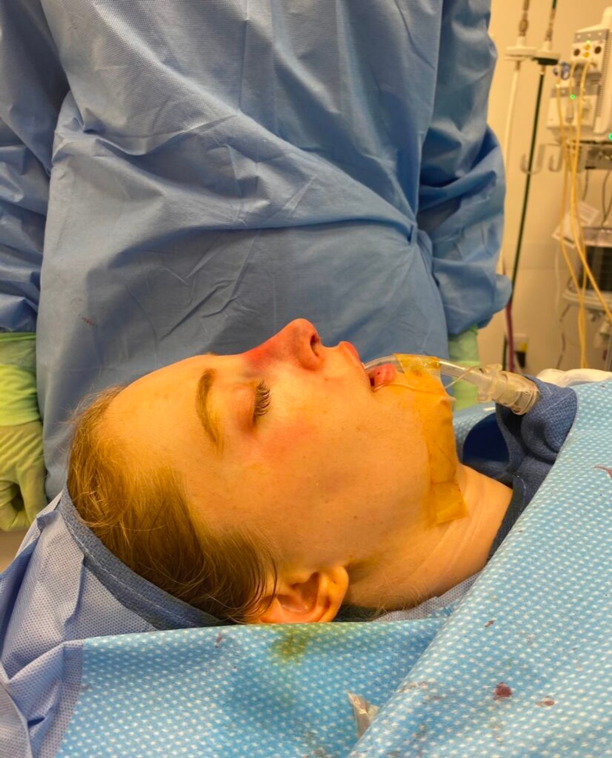 Jillian Gottlieb nose job surgery 