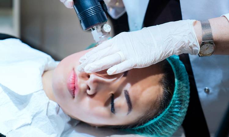 vampire facial HIV