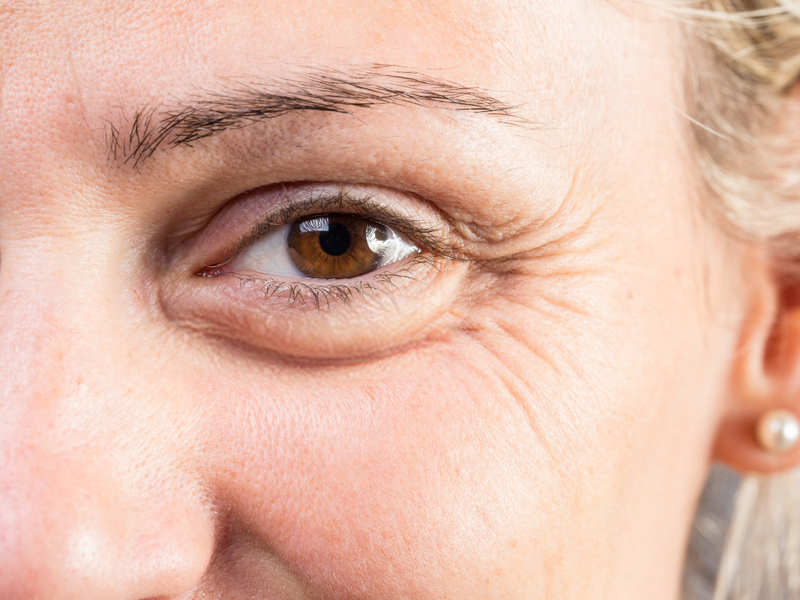 how to fix under-eye-bags