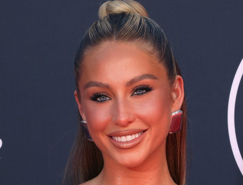 alix earle accutane nose job