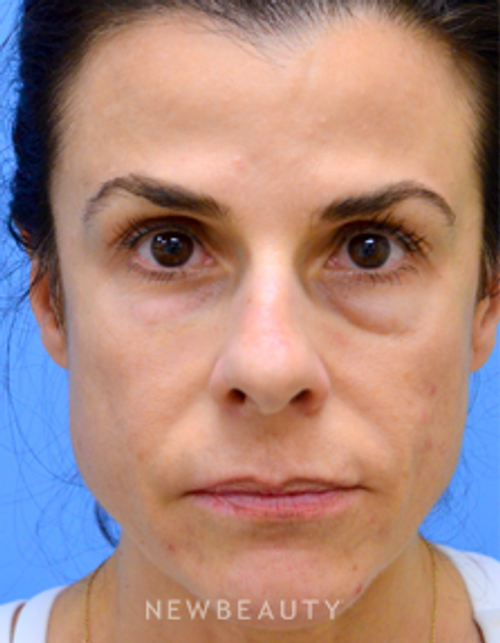 Dr. Mokhtar Asaadi - Matching Aesthetics - Before