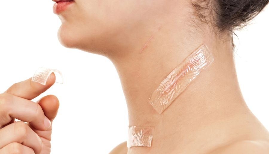 The Best At-Home and In-Office Treatments for Fading Scars