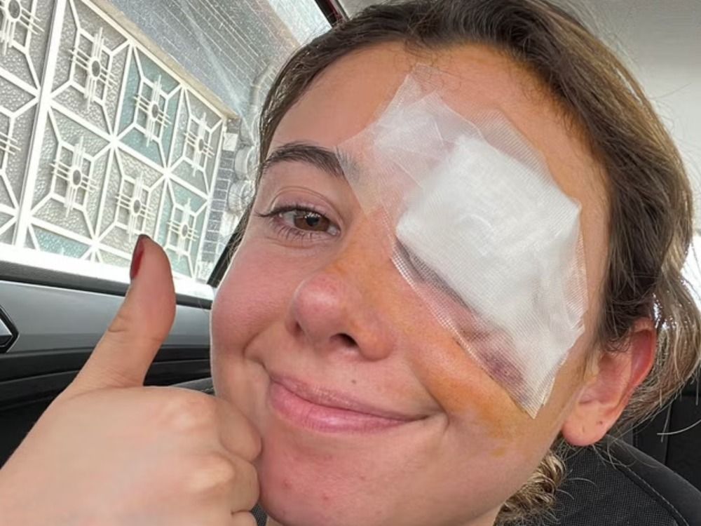 This TikTok Hack Left One Woman Requiring Eye Surgery