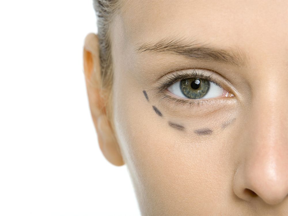 The Exact Techniques this Eye Surgeon Uses to Get Prettier, Younger-Looking Eyes