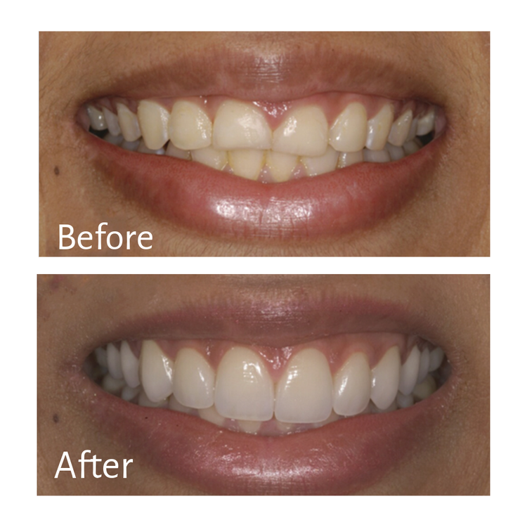 Naturally Restored