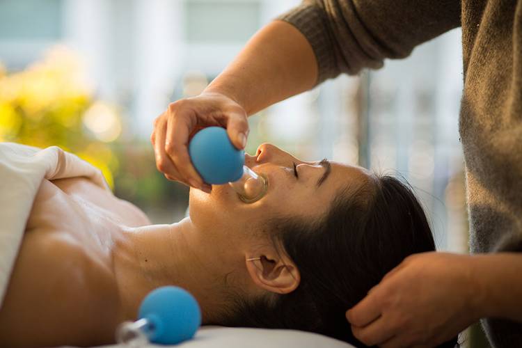 facialcupping