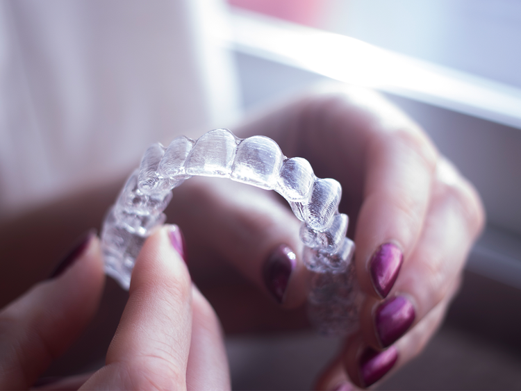 Why This Top Dentist Sometimes Recommends Invisalign Instead of Porcelain Veneers