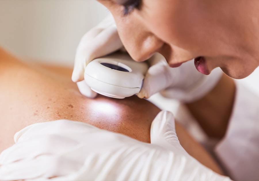 Dermatologist examining a patient’s skin with a dermatoscope during a skin cancer check.