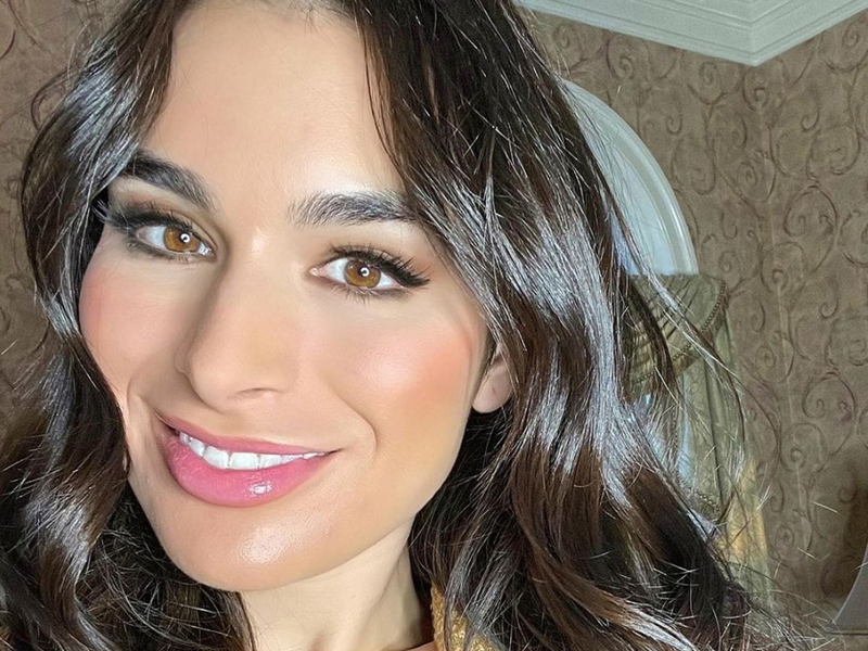 Ashley Iaconetti Gets Real About Her Pregnancy-Induced Acne