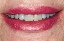 Guy M. Lewis, DDS - 23776910 - Dazzling Transformation - Before