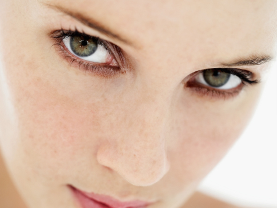 darkcircles Main Newbeauty