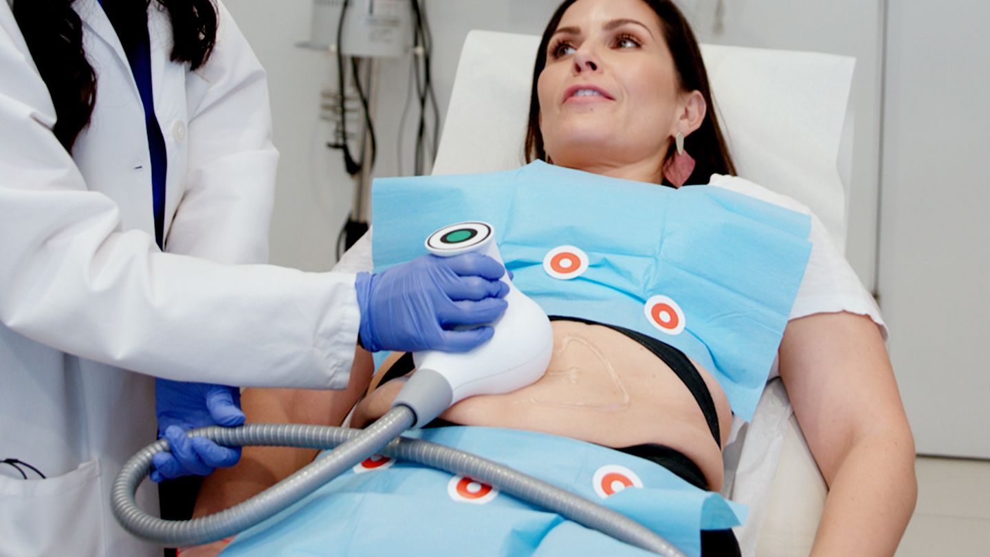 Ultrashape SiteThumb 