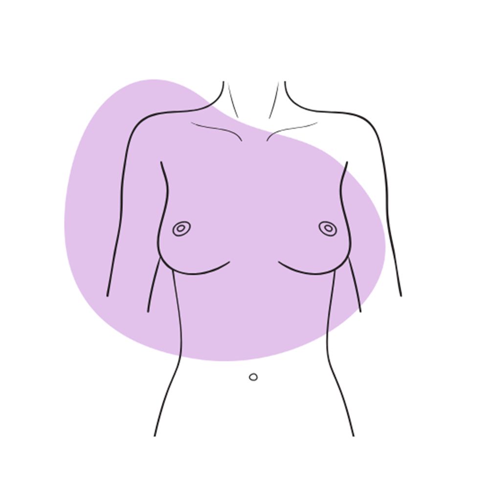 Step 1: Examine Your Breasts in a Mirror With Hands on Hips