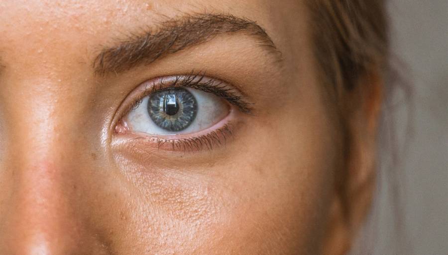woman's under-eye