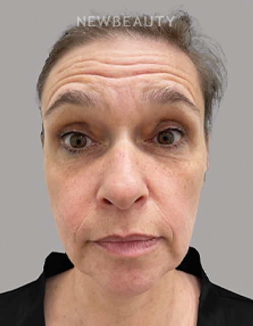 Dr. Drew Schnitt - Timeless Transformation - 44690229 - Before