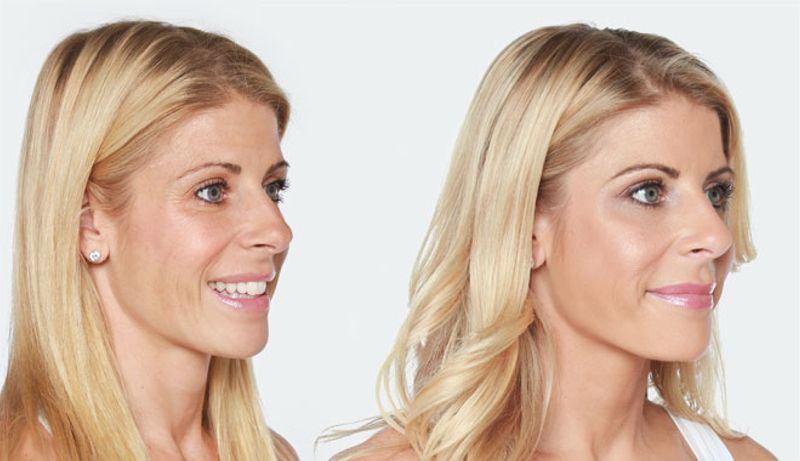 LIQUID LIFT MAKEOVER