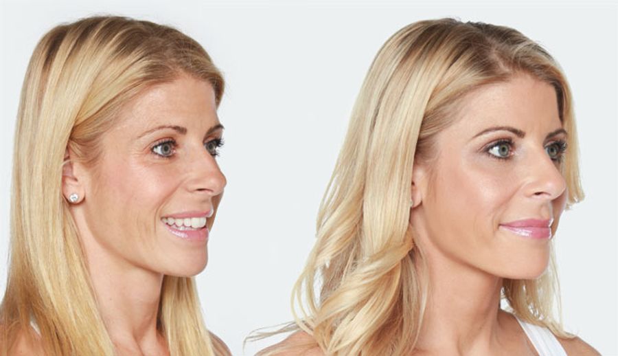 LIQUID LIFT MAKEOVER