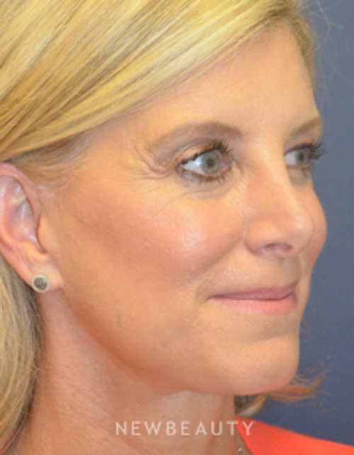 Drs. Lieberman & Parikh - Shedding the Stress - After