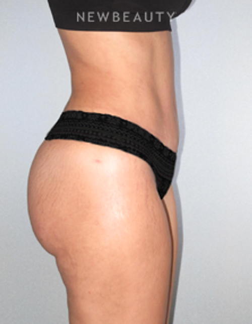 Dr. German Newall - Dramatic Transformation - After