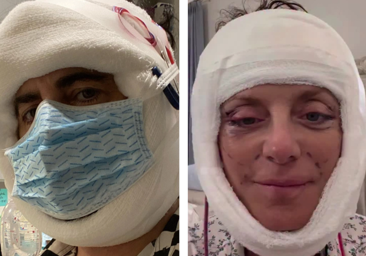 Marc Jacobs (left) in bandages post-facelift; Kathy Wilke (right) in bandages post-facelift