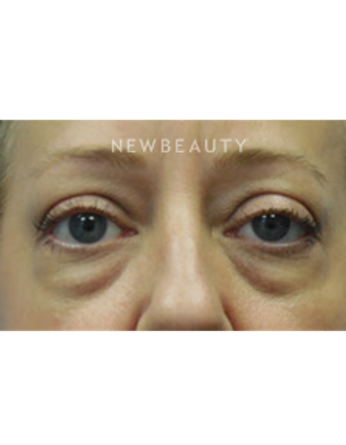 Dr. Christine Hamori - A Brighter Outlook - Before