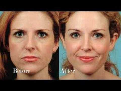 Dr. Mentz Facial Rejuvenation