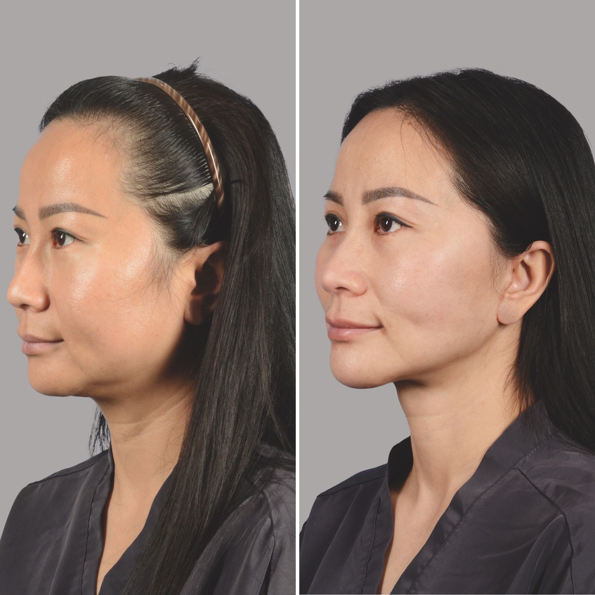 Houston, TX plastic surgeon Henry Mentz, MD