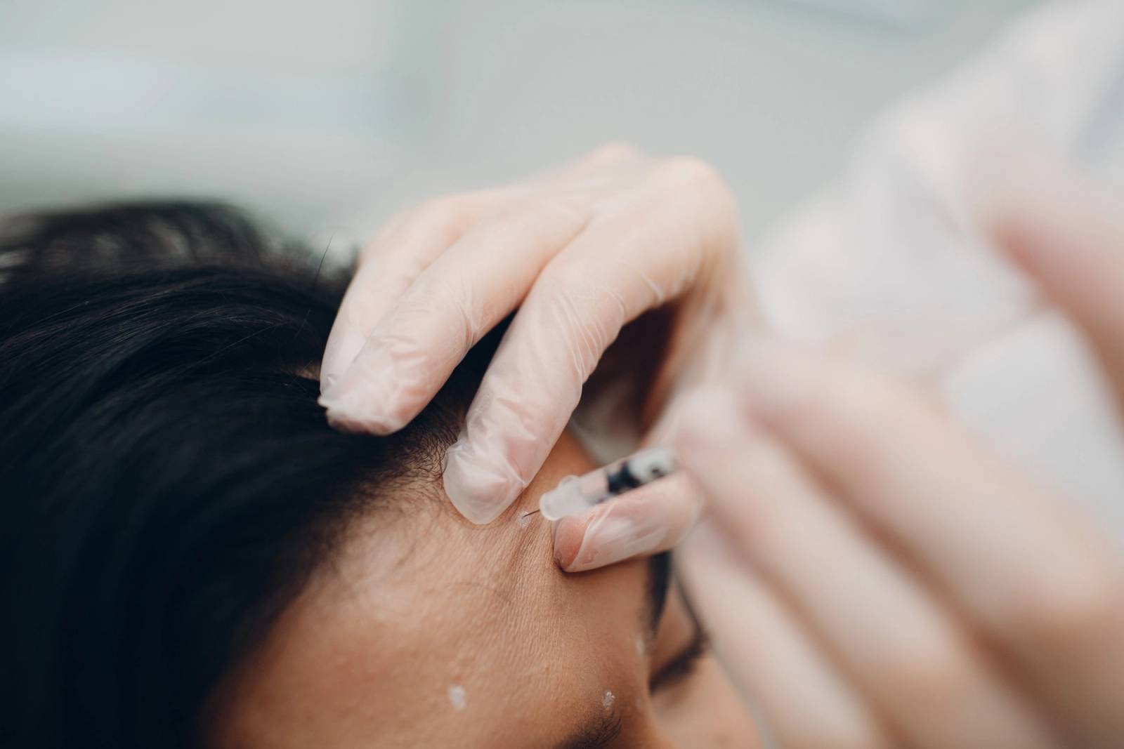 These ‘Bad Botox’ Before and Afters Will Forever Have You Doing Your ...