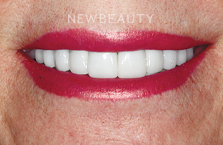 Guy M. Lewis, DDS - 23776910 - Dazzling Transformation - After