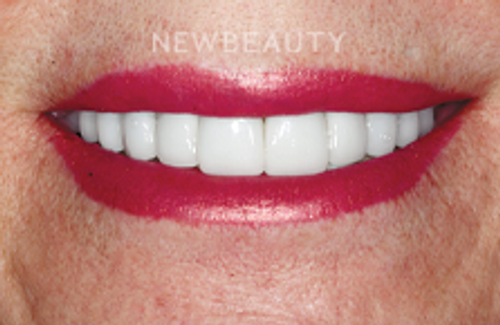 Guy M. Lewis, DDS - 23776910 - Dazzling Transformation - After