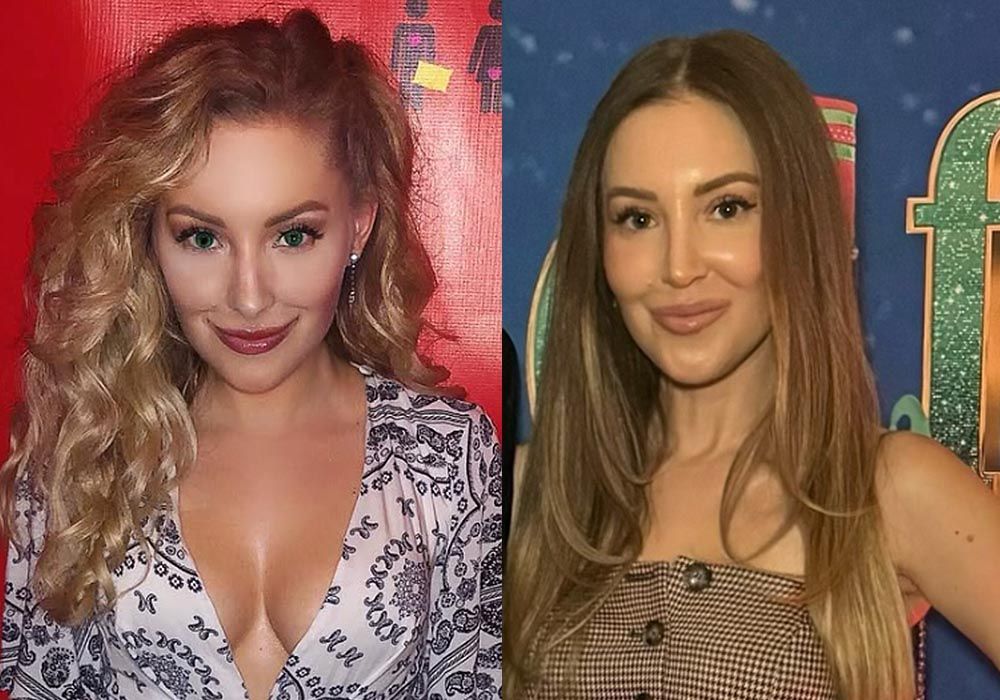 jilliangottlieb-nosejob