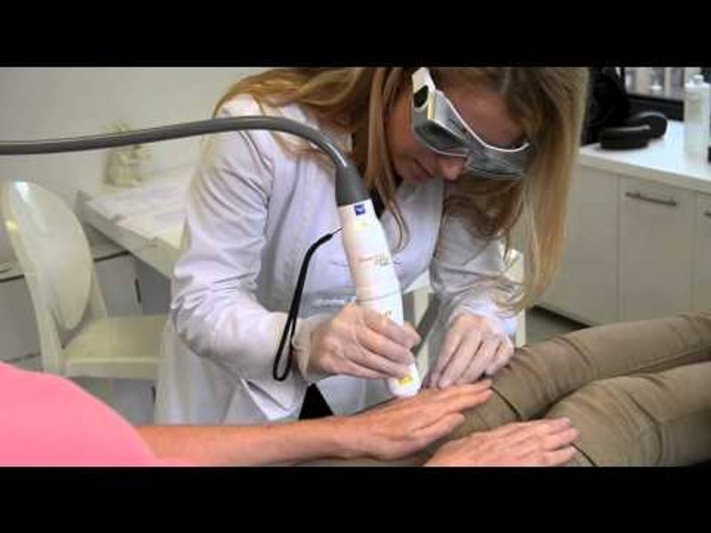 Dr. Russak: Fractional Laser Resurfacing at Russak Dermatology Clinic