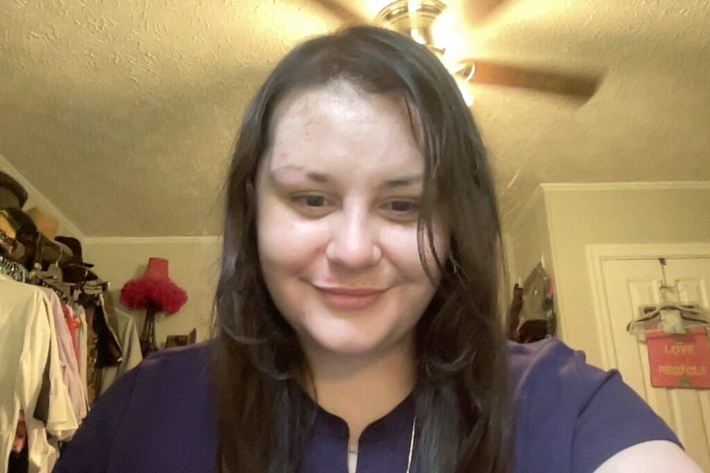 Rowan Lynam befpre using UNITE TEXTURIZA