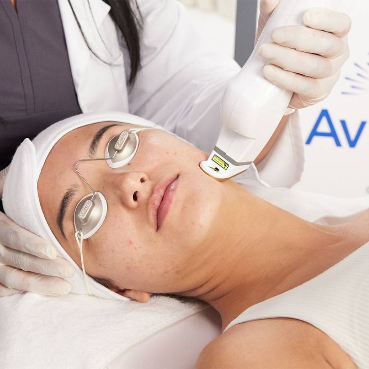AviClear