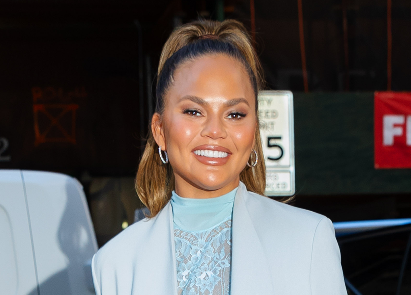Chrissy Teigen Just Got an Eyebrow Hair Transplant