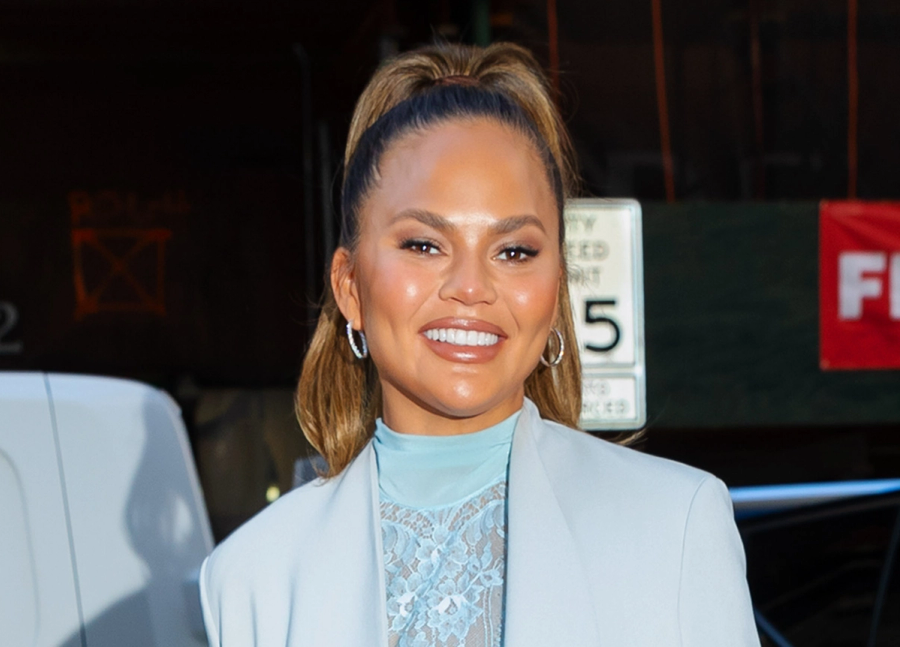 Chrissy Teigen Just Got an Eyebrow Hair Transplant