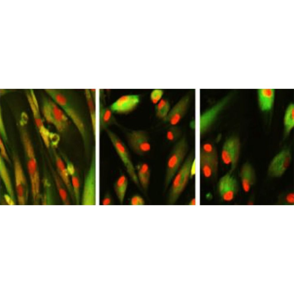 Three slides showing matured human skin cells (left), restored with chemicals (right), which can be seen from the way proteins (red blobs) change from streaky to concentrated. Center slide shows transition.