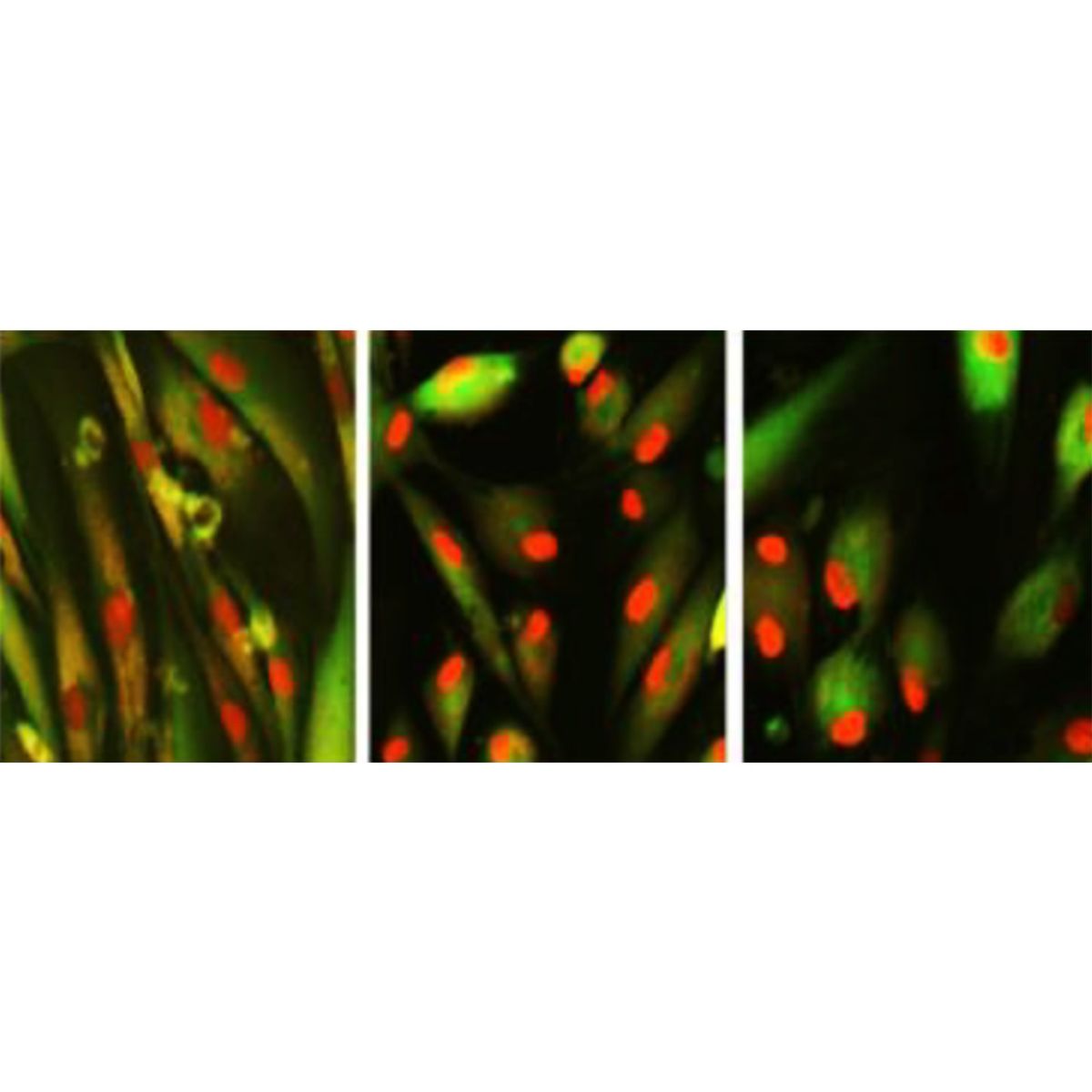 Three slides showing matured human skin cells (left), restored with chemicals (right), which can be seen from the way proteins (red blobs) change from streaky to concentrated. Center slide shows transition. 