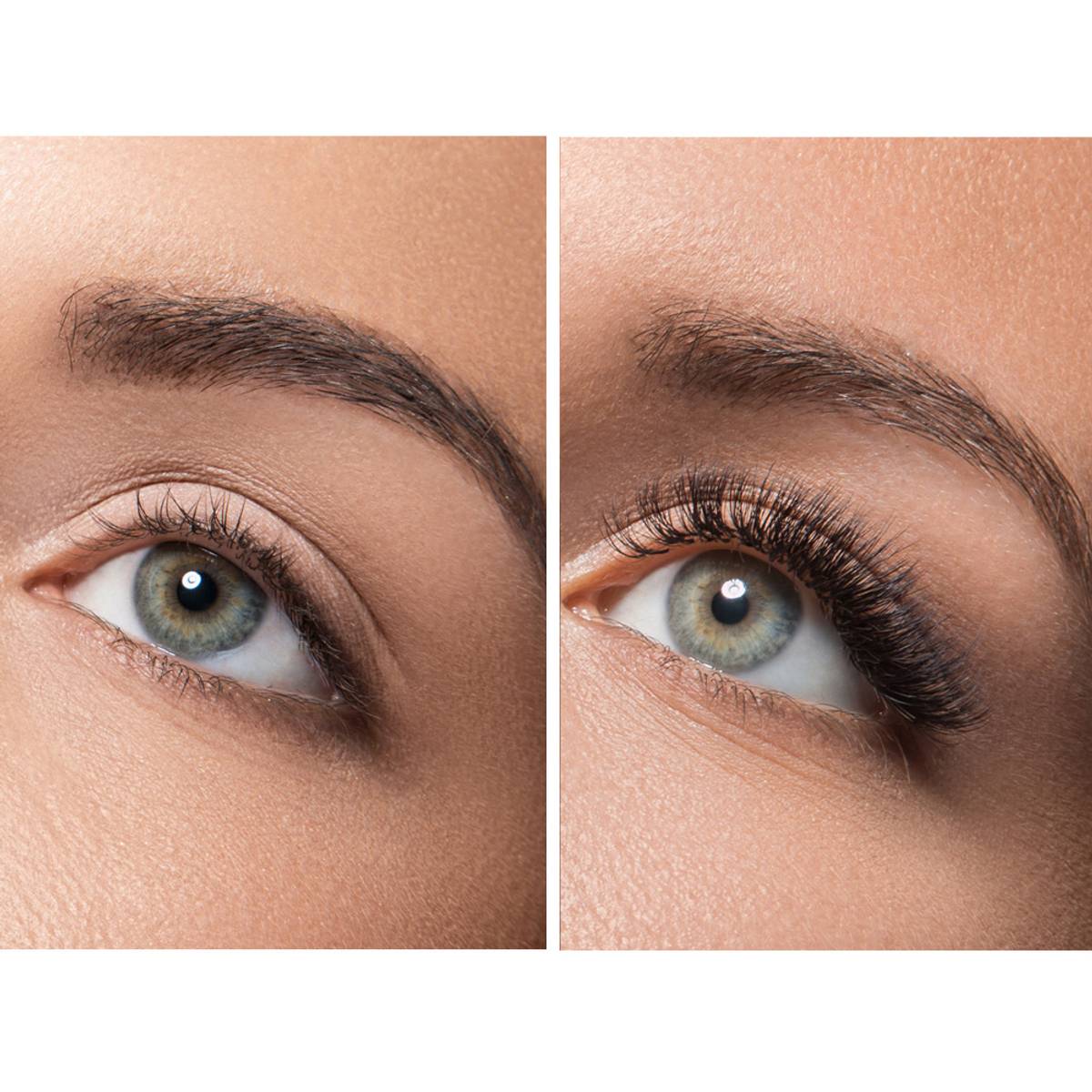 EyelashTransplant