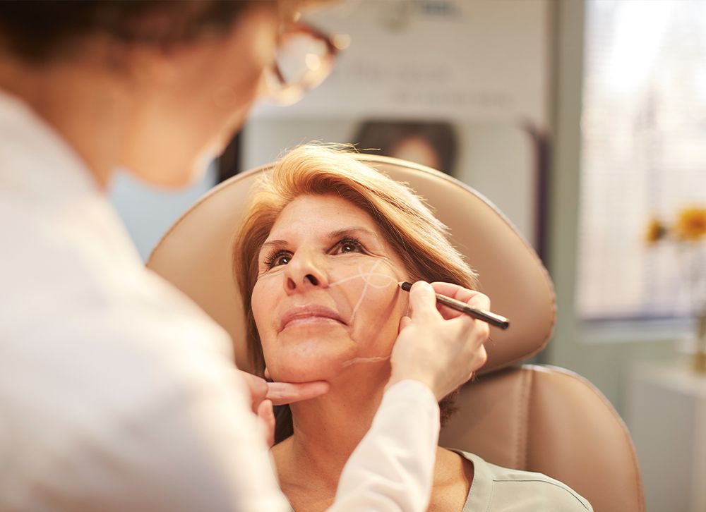 facelift consultation