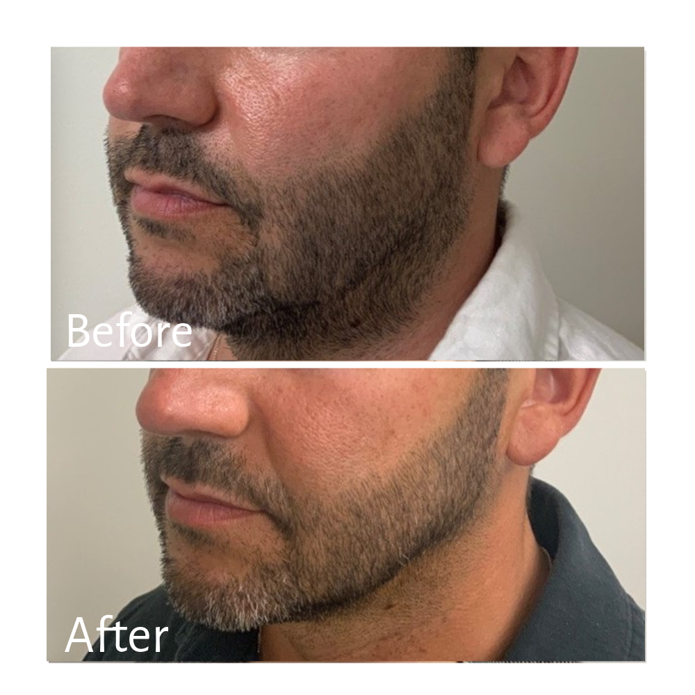 Jaw and Chin in Harmony