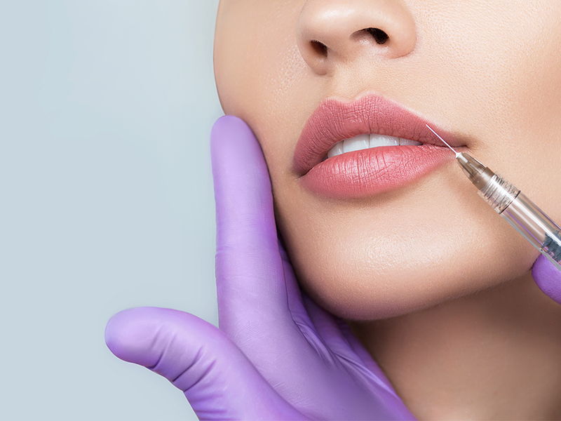 The In-Office Treatment That Gave This Woman’s Confidence a Boost