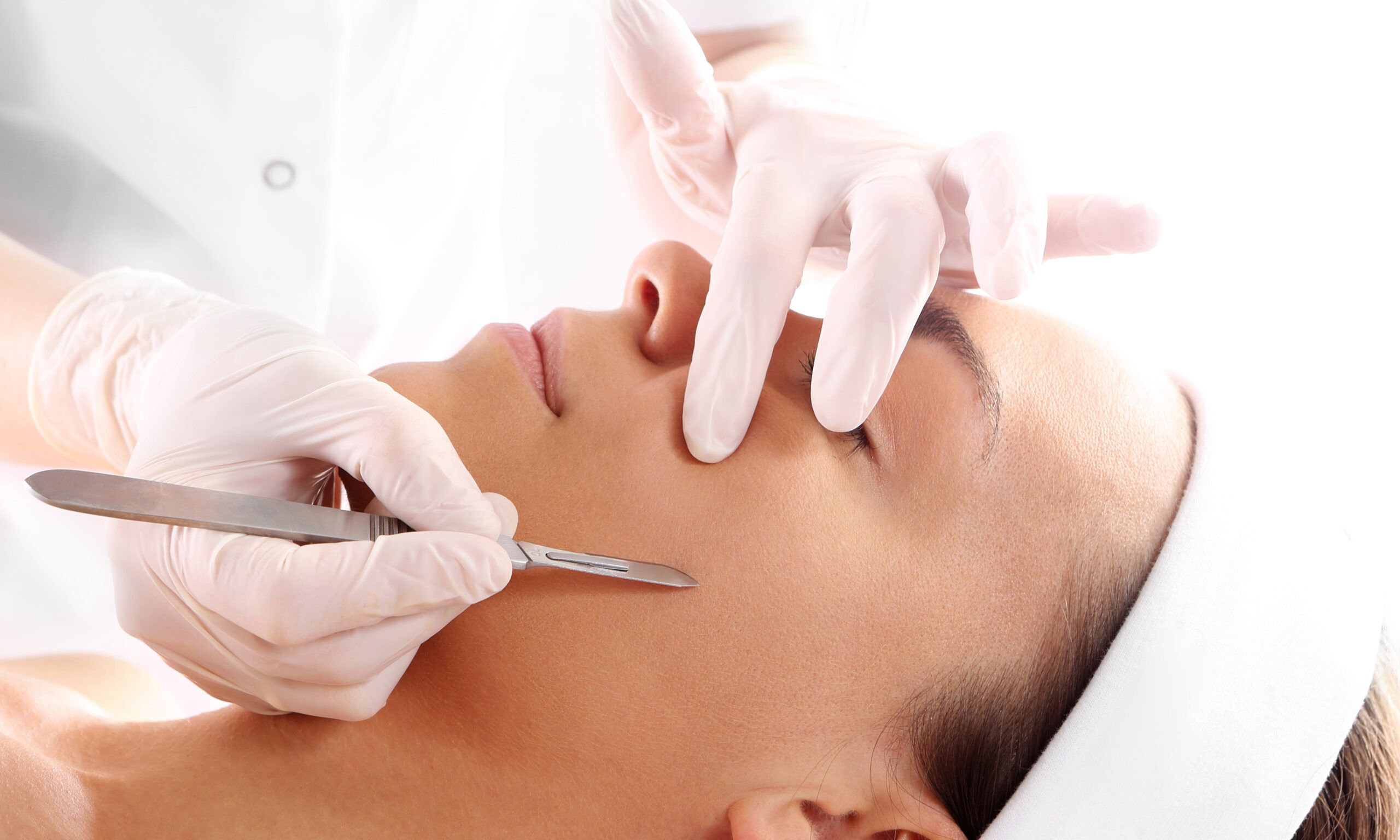 what is dermaplaning