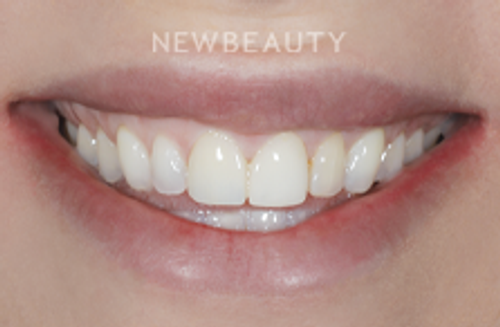 Dr. Brian Klaich - Beautiful Restoration - 22247129 - Before